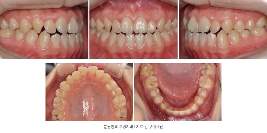 86cbe8e8a58c593012a2759ba9fd6148 1773363169 347