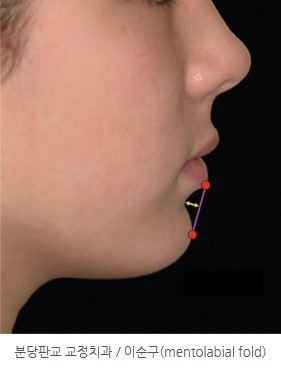 86cbe8e8a58c593012a2759ba9fd6148 1773363169 4016