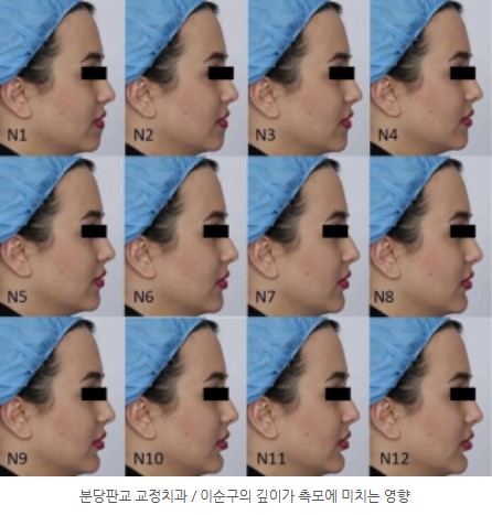 86cbe8e8a58c593012a2759ba9fd6148 1773363169 4272