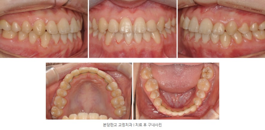 86cbe8e8a58c593012a2759ba9fd6148 1773363169 4572