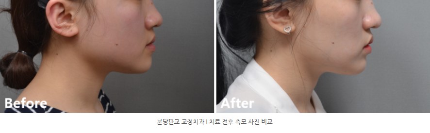 86cbe8e8a58c593012a2759ba9fd6148 1773363169 4844