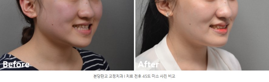 86cbe8e8a58c593012a2759ba9fd6148 1773363169 5102