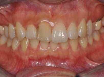 17d3464fbe306615f4c0872950d20c05_1763432358_3152.png 17d3464fbe306615f4c0872950d20c05_1763432358_3152.png