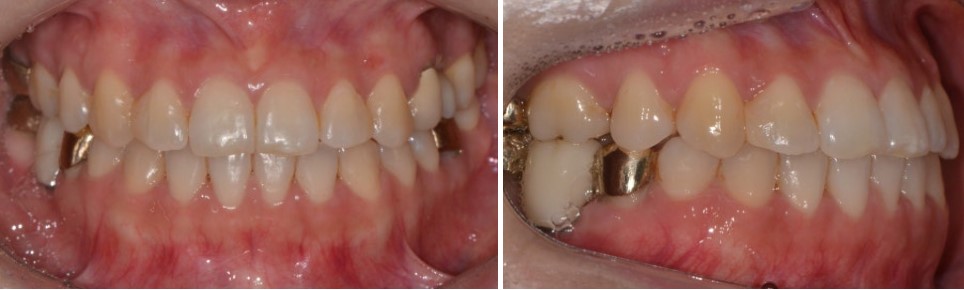 17d3464fbe306615f4c0872950d20c05_1763440610_4607.jpg 17d3464fbe306615f4c0872950d20c05_1763440610_4607.jpg