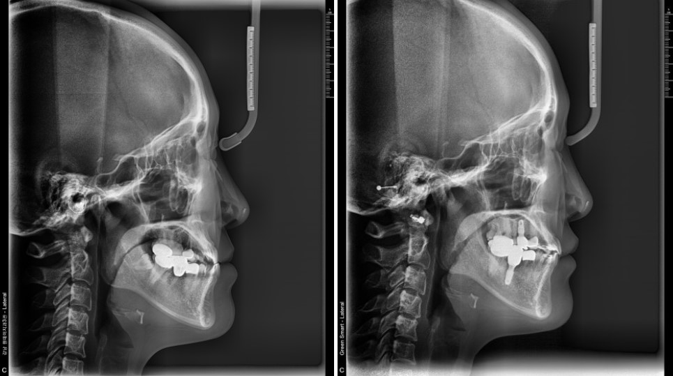 17d3464fbe306615f4c0872950d20c05_1763440610_4976.jpg 17d3464fbe306615f4c0872950d20c05_1763440610_4976.jpg