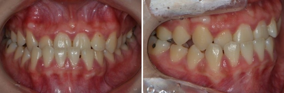 17d3464fbe306615f4c0872950d20c05_1763440610_5278.jpg 17d3464fbe306615f4c0872950d20c05_1763440610_5278.jpg