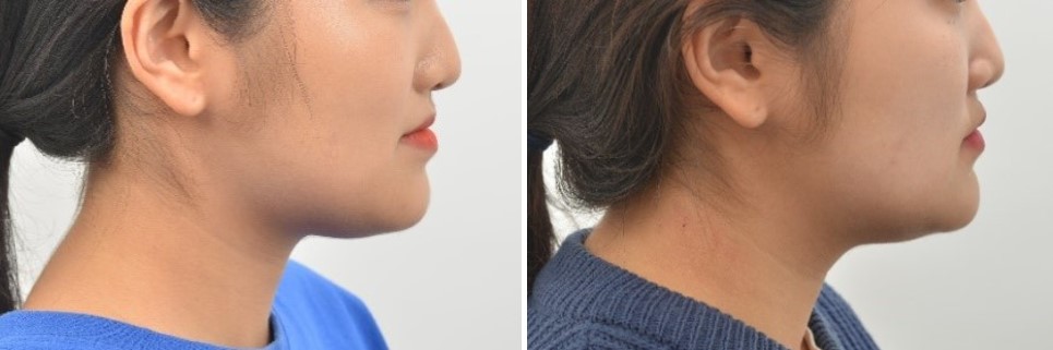 17d3464fbe306615f4c0872950d20c05_1763440610_5882.jpg 17d3464fbe306615f4c0872950d20c05_1763440610_5882.jpg