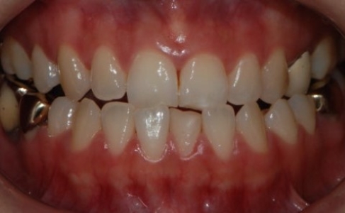 17d3464fbe306615f4c0872950d20c05_1763440924_181.jpg 17d3464fbe306615f4c0872950d20c05_1763440924_181.jpg