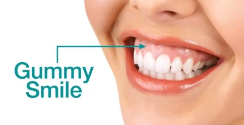 17d3464fbe306615f4c0872950d20c05_1763458550_6078.jpg 17d3464fbe306615f4c0872950d20c05_1763458550_6078.jpg