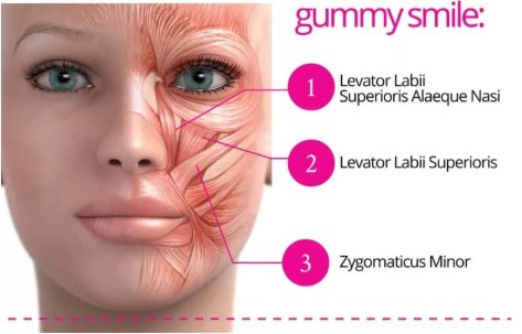 17d3464fbe306615f4c0872950d20c05_1763458550_6626.jpg 17d3464fbe306615f4c0872950d20c05_1763458550_6626.jpg