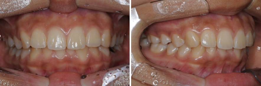 17d3464fbe306615f4c0872950d20c05_1763458550_6912.jpg 17d3464fbe306615f4c0872950d20c05_1763458550_6912.jpg