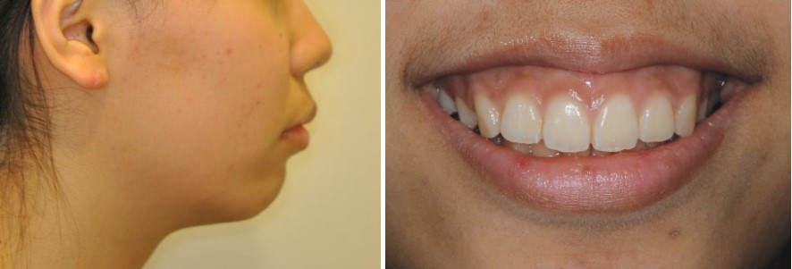 17d3464fbe306615f4c0872950d20c05_1763458550_721.jpg 17d3464fbe306615f4c0872950d20c05_1763458550_721.jpg