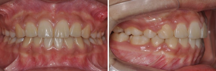 17d3464fbe306615f4c0872950d20c05_1763458550_7494.jpg 17d3464fbe306615f4c0872950d20c05_1763458550_7494.jpg