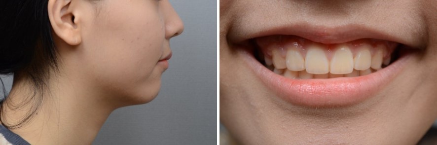 17d3464fbe306615f4c0872950d20c05_1763458550_7772.jpg 17d3464fbe306615f4c0872950d20c05_1763458550_7772.jpg