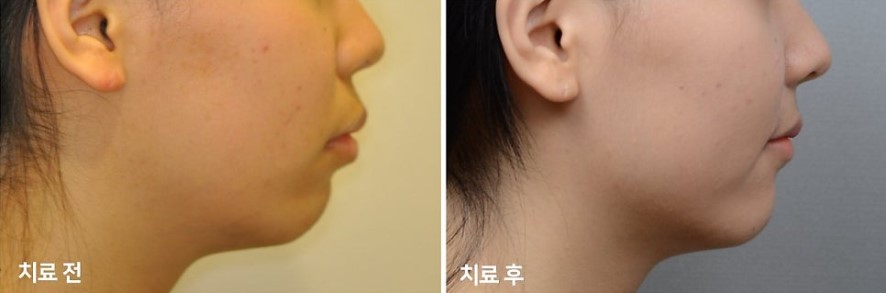 17d3464fbe306615f4c0872950d20c05_1763458550_8062.jpg 17d3464fbe306615f4c0872950d20c05_1763458550_8062.jpg