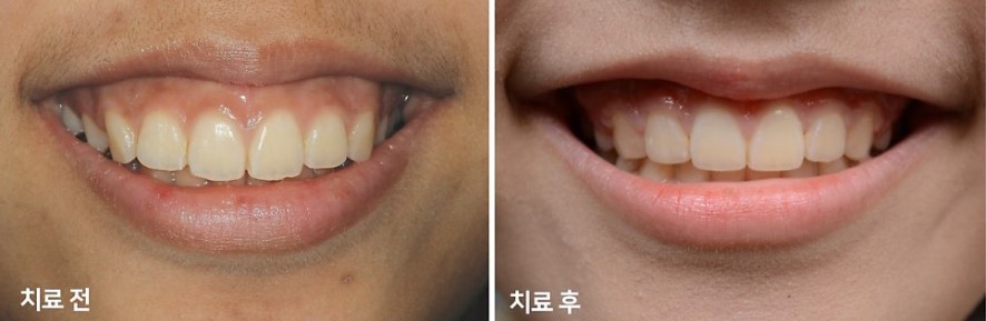 17d3464fbe306615f4c0872950d20c05_1763458550_8354.jpg 17d3464fbe306615f4c0872950d20c05_1763458550_8354.jpg