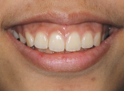 17d3464fbe306615f4c0872950d20c05_1763460989_7822.jpg 17d3464fbe306615f4c0872950d20c05_1763460989_7822.jpg