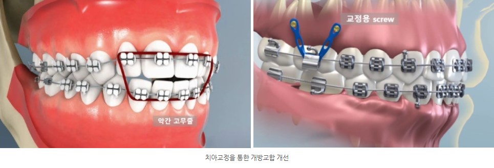 747569ca512315b293293d02a0866f62_1763606451_8709.jpg 747569ca512315b293293d02a0866f62_1763606451_8709.jpg