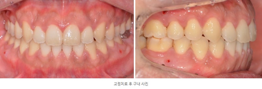 747569ca512315b293293d02a0866f62_1763606451_933.jpg 747569ca512315b293293d02a0866f62_1763606451_933.jpg