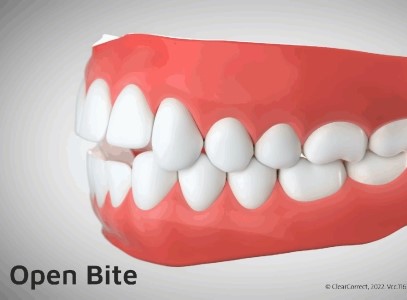 747569ca512315b293293d02a0866f62_1763607109_2742.jpg 747569ca512315b293293d02a0866f62_1763607109_2742.jpg