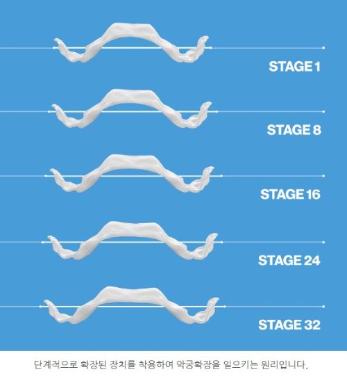 8b8ac98e3e420bd380411d6b03f60516_1763777725_3738.jpg 8b8ac98e3e420bd380411d6b03f60516_1763777725_3738.jpg