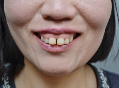 8c281ed844084147b1952c521214fc8f_1763539496_6126.jpg 8c281ed844084147b1952c521214fc8f_1763539496_6126.jpg