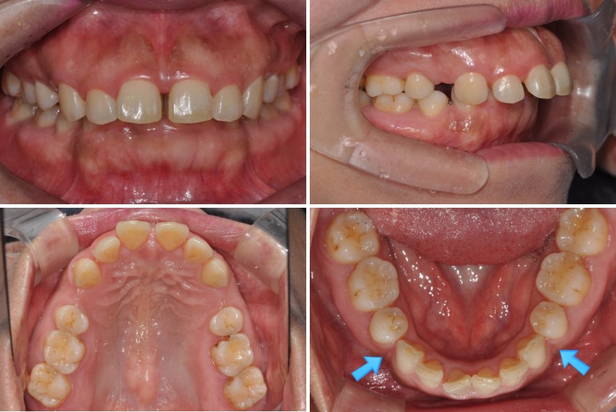 8c281ed844084147b1952c521214fc8f_1763539811_2789.jpg 8c281ed844084147b1952c521214fc8f_1763539811_2789.jpg