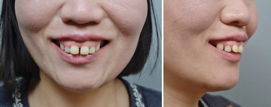 8c281ed844084147b1952c521214fc8f_1763539811_3431.jpg 8c281ed844084147b1952c521214fc8f_1763539811_3431.jpg