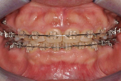 8c281ed844084147b1952c521214fc8f_1763539811_3747.jpg 8c281ed844084147b1952c521214fc8f_1763539811_3747.jpg