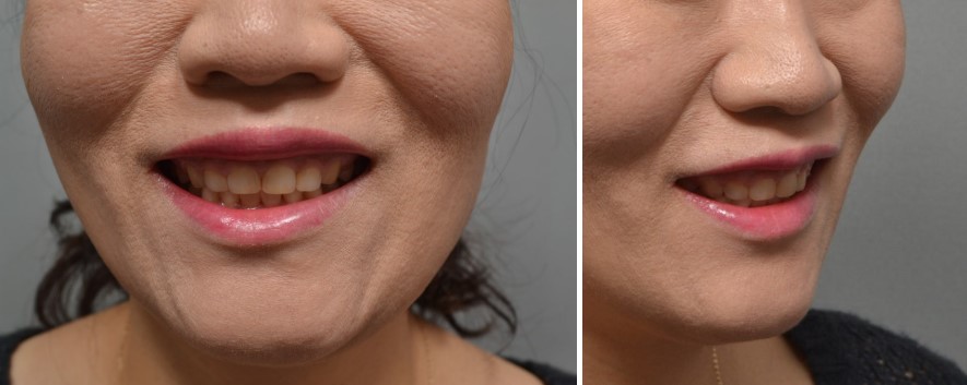 8c281ed844084147b1952c521214fc8f_1763539811_4059.jpg 8c281ed844084147b1952c521214fc8f_1763539811_4059.jpg