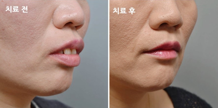 8c281ed844084147b1952c521214fc8f_1763540105_7857.jpg 8c281ed844084147b1952c521214fc8f_1763540105_7857.jpg