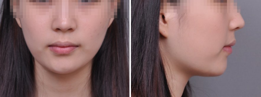 8c281ed844084147b1952c521214fc8f_1763543600_6891.jpg 8c281ed844084147b1952c521214fc8f_1763543600_6891.jpg