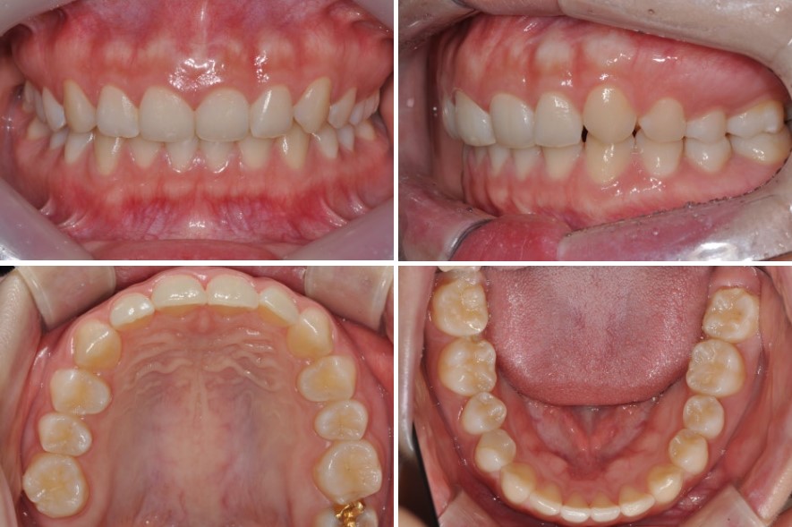 8c281ed844084147b1952c521214fc8f_1763543600_7336.jpg 8c281ed844084147b1952c521214fc8f_1763543600_7336.jpg