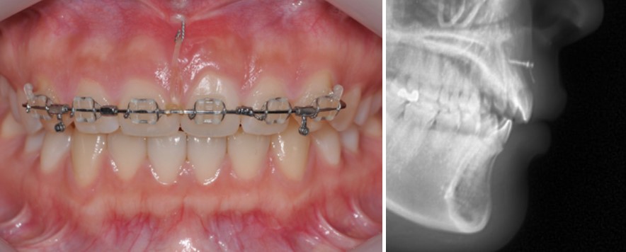 8c281ed844084147b1952c521214fc8f_1763543600_8228.jpg 8c281ed844084147b1952c521214fc8f_1763543600_8228.jpg