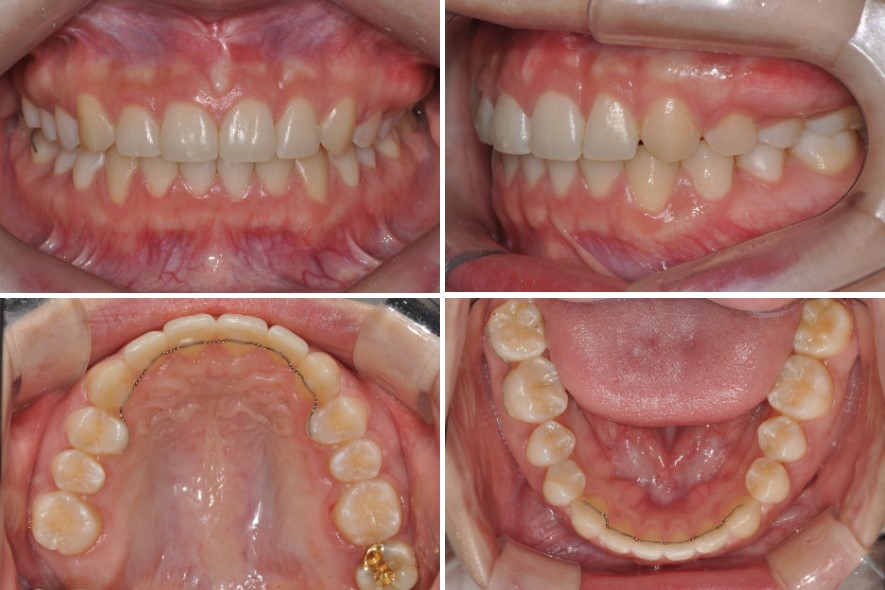 8c281ed844084147b1952c521214fc8f_1763543600_8915.jpg 8c281ed844084147b1952c521214fc8f_1763543600_8915.jpg