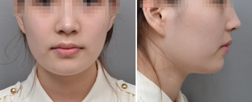 8c281ed844084147b1952c521214fc8f_1763543600_924.jpg 8c281ed844084147b1952c521214fc8f_1763543600_924.jpg