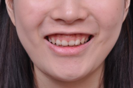 8c281ed844084147b1952c521214fc8f_1763543824_3024.jpg 8c281ed844084147b1952c521214fc8f_1763543824_3024.jpg