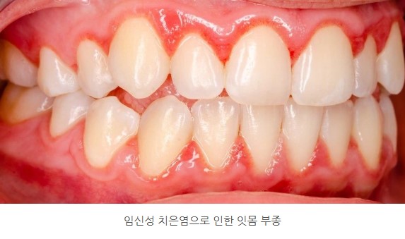 94f16cfbafd0ef5dc340257b8654e0e5_1763707801_5408.jpg 94f16cfbafd0ef5dc340257b8654e0e5_1763707801_5408.jpg