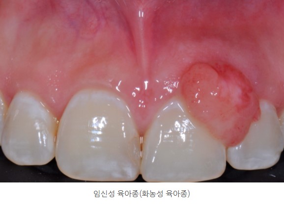 94f16cfbafd0ef5dc340257b8654e0e5_1763707801_5844.jpg 94f16cfbafd0ef5dc340257b8654e0e5_1763707801_5844.jpg