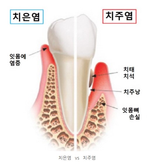 94f16cfbafd0ef5dc340257b8654e0e5_1763707801_617.jpg 94f16cfbafd0ef5dc340257b8654e0e5_1763707801_617.jpg