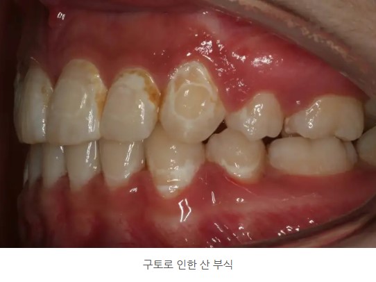 94f16cfbafd0ef5dc340257b8654e0e5_1763707801_6494.jpg 94f16cfbafd0ef5dc340257b8654e0e5_1763707801_6494.jpg