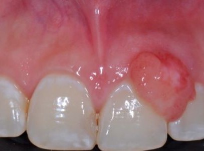 94f16cfbafd0ef5dc340257b8654e0e5_1763708033_2035.jpg 94f16cfbafd0ef5dc340257b8654e0e5_1763708033_2035.jpg