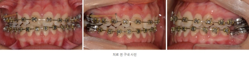 a3728e8dc2bb21dd96d495113a3c4be5_1764210832_4808.jpg a3728e8dc2bb21dd96d495113a3c4be5_1764210832_4808.jpg