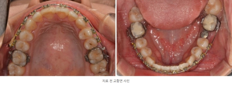 a3728e8dc2bb21dd96d495113a3c4be5_1764210832_5314.jpg a3728e8dc2bb21dd96d495113a3c4be5_1764210832_5314.jpg