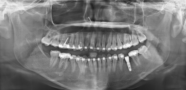 a3728e8dc2bb21dd96d495113a3c4be5_1764210832_5664.jpg a3728e8dc2bb21dd96d495113a3c4be5_1764210832_5664.jpg