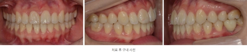 a3728e8dc2bb21dd96d495113a3c4be5_1764210832_5999.jpg a3728e8dc2bb21dd96d495113a3c4be5_1764210832_5999.jpg