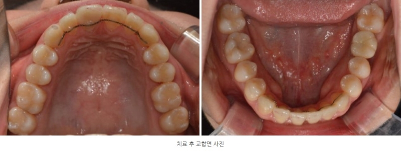 a3728e8dc2bb21dd96d495113a3c4be5_1764210832_6405.jpg a3728e8dc2bb21dd96d495113a3c4be5_1764210832_6405.jpg