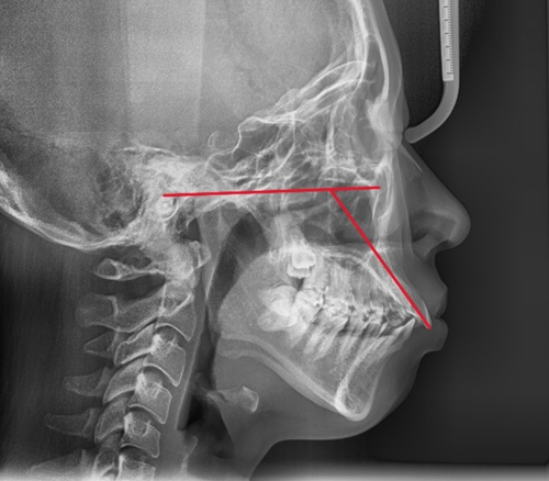 c546f0529c1184f2b681a26711ec1374_1763205813_8031.png c546f0529c1184f2b681a26711ec1374_1763205813_8031.png