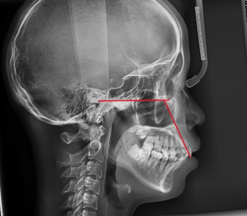 c546f0529c1184f2b681a26711ec1374_1763205813_8646.png c546f0529c1184f2b681a26711ec1374_1763205813_8646.png