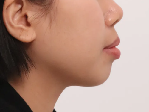 c546f0529c1184f2b681a26711ec1374_1763205814_0332.png c546f0529c1184f2b681a26711ec1374_1763205814_0332.png